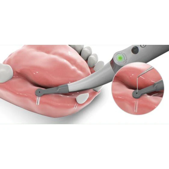 What is the maximal depth for implant detection using the Spotter?