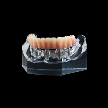 PB-6 Implant Supported Hybrid Denture Model Questions & Answers